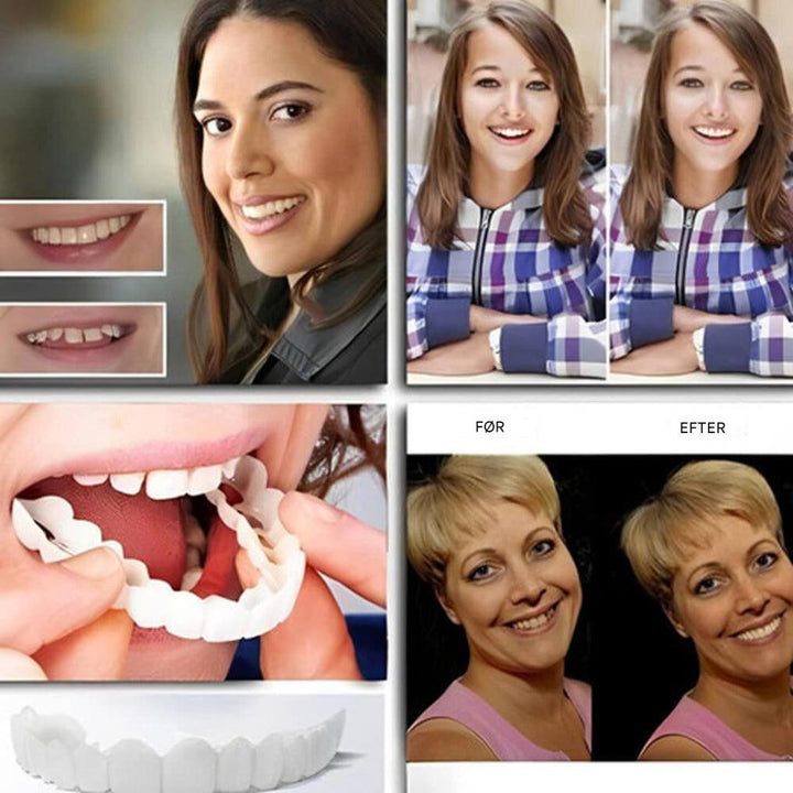Clip-On tandfacader – Smil med selvtillid