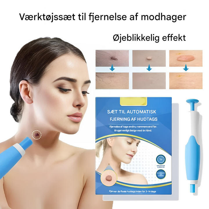 Skin Tag Fjernelsessæt